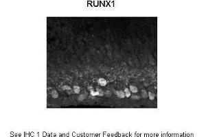 Sample Type : Mouse, post-natal day (p) 0 retinal ganglion cells Primary Antibody Dilution : 1:1500 Secondary Antibody : Donkey anti rabbit IgG Alexa 594 Secondary Antibody Dilution : 1:1000 Gene Name : RUNX1  Submitted by : Anonymous (RUNX1 antibody  (Middle Region))