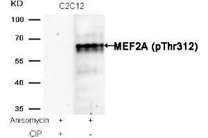 Western blot analysis of extracts from C2C12 cells, treated with Anisomycin or calf intestinal phosphatase (CIP), using MEF2A (Phospho-Thr312) Antibody.
