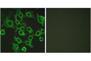 Immunofluorescence analysis of COS7 cells, using CCRL2 Antibody. (CCRL2 antibody  (AA 141-190))