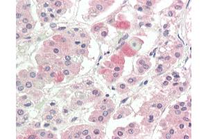 Human, Adrenal: Formalin-Fixed Paraffin-Embedded (FFPE). (SLC1A4 antibody  (C-Term))