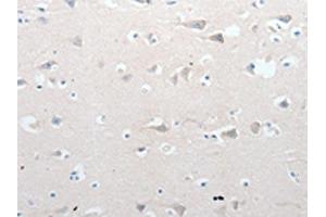 The image on the left is immunohistochemistry of paraffin-embedded Human brain tissue using ABIN7190766(GCH1 Antibody) at dilution 1/15, on the right is treated with synthetic peptide. (GCH1 antibody)