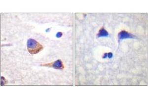 Immunohistochemistry analysis of paraffin-embedded human brain, using JAK3 (Phospho-Tyr785) Antibody. (JAK3 antibody  (pTyr785))