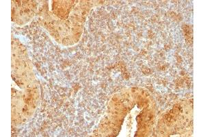 Formalin-fixed, paraffin-embedded human Salivary Tumor stained with Cytochrome C Mouse Monoclonal Antibody (7H8. (Cytochrome C antibody  (AA 1-80))