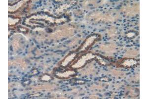 Figure. (RBP1 antibody  (AA 2-135))