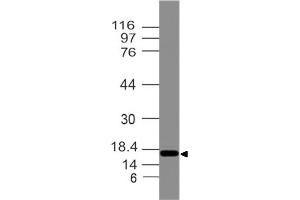 Image no. 1 for anti-Developmental Pluripotency Associated 3 Pseudogene 2 (DPPA3P2) antibody (ABIN5027789) (STELLAR antibody)