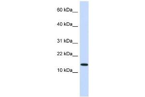 Western Blot showing NME1 antibody used at a concentration of 1 ug/ml against Fetal Heart Lysate