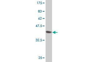 Western Blot detection against Immunogen (37. (IL1RAPL1 antibody  (AA 151-250))