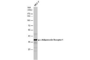 WB Image Adiponectin Receptor 1 antibody detects Adiponectin Receptor 1 protein by western blot analysis. (Adiponectin Receptor 1 antibody  (C-Term))