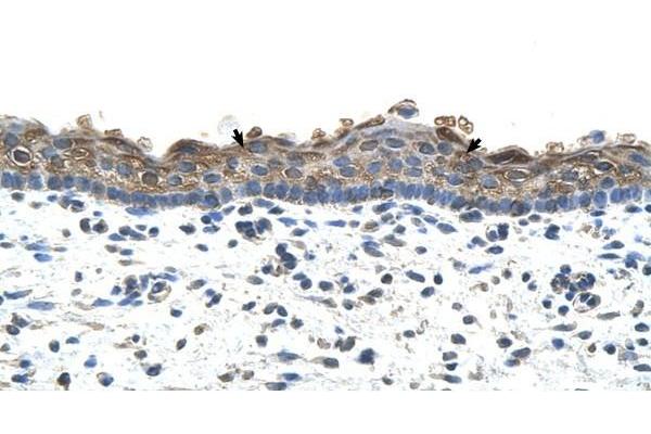 SLC26A1 antibody