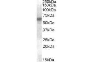 Image no. 1 for anti-V-Yes-1 Yamaguchi Sarcoma Viral Related Oncogene Homolog (LYN) (Internal Region) antibody (ABIN263174)