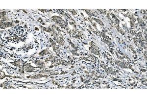 IHC analysis of Carbonic Anhydrase I/CA1 using anti-Carbonic Anhydrase I/CA1 antibody (ABIN7602621).