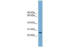 LRRC3 antibody used at 1 ug/ml to detect target protein. (LRRC3 antibody  (Middle Region))