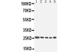 Anti-HOXA6 antibody, Western blotting Lane 1: SW620 cell Lysate Lane 2: SW620 cell Lysate Lane 3: HELA cell Lysate Lane 4:  cell Lysate Lane 5:  cell Lysate (HOXA6 antibody  (Middle Region))