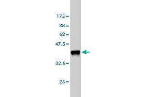 Western Blot detection against Immunogen (36. (M-CSF/CSF1 antibody  (AA 33-132))