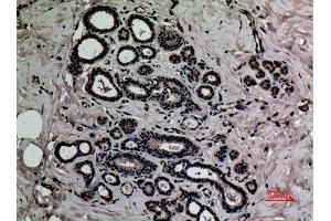 Immunohistochemistry (IHC) analysis of paraffin-embedded Human Breast, antibody was diluted at 1:100. (HMGB1 antibody  (acLys12))