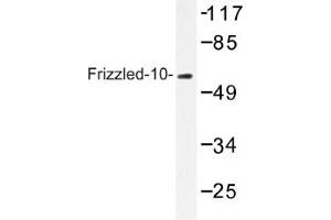 Image no. 1 for anti-Frizzled Family Receptor 10 (FZD10) antibody (ABIN317639) (FZD10 antibody)