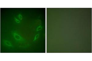 Immunofluorescence analysis of HeLa cells, using HSP105 antibody (ABIN5976428).