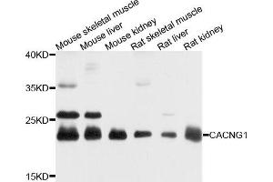 Western blot analysis of extracts of various cells, using CACNG1 antibody. (CACNG1 antibody)