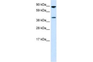 Western Blotting (WB) image for anti-Ets Variant 4 (ETV4) antibody (ABIN2460408) (ETV4 antibody)