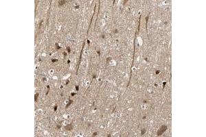 Immunohistochemical staining of human cerebral cortex with HECW1 polyclonal antibody  shows strong nuclear and cytoplasmic positivity in neuronal cells at 1:10-1:20 dilution. (HECW1 antibody)