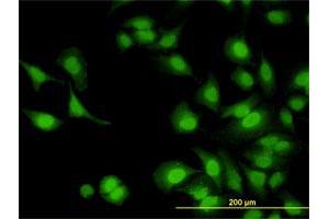 Immunofluorescence of monoclonal antibody to IRAK1 on HeLa cell.