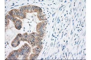 Immunohistochemistry (IHC) image for anti-Eukaryotic Translation Initiation Factor 2 Subunit 1 (EIF2S1) antibody (ABIN1497972) (EIF2S1 antibody)
