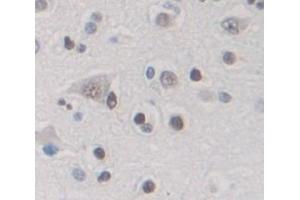 Figure. (DYRK1A antibody  (AA 16-300))