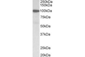 Western Blotting (WB) image for anti-Gelsolin (GSN) (N-Term) antibody (ABIN2465079) (Gelsolin antibody  (N-Term))