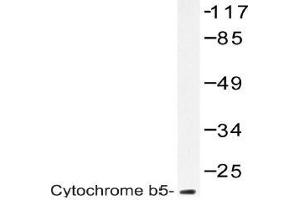Western blot (WB) analysis of Cytochrome b5 antibody in extracts from A549 cells. (CYB5R3 antibody)