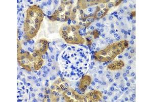 Immunohistochemistry of paraffin-embedded Mouse kidney using KRT19 Polyclonal Antibody at dilution of 1:100 (40x lens). (Cytokeratin 19 antibody)