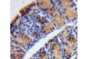 Used in DAB staining on fromalin fixed paraffin-embedded Bowels tissue (TPSD1 antibody  (AA 99-191))