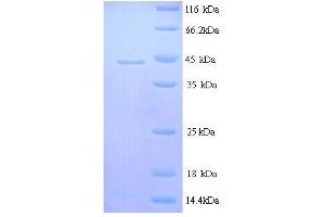 IL-6 (AA 30-208), (full length) protein (His tag)