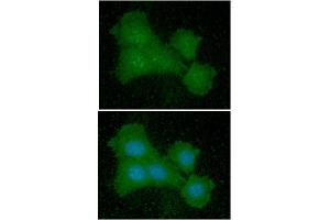 ICC/IF analysis of EIF5A in Balb/3T3 cells line, stained with DAPI (Blue) for nucleus staining and monoclonal anti-human EIF5A antibody (1:100) with goat anti-mouse IgG-Alexa fluor 488 conjugate (Green) (EIF5A antibody)