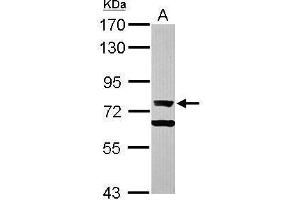 WB Image Sample (30 ug of whole cell lysate) A: Raji 7. (XRCC6 antibody)