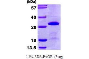 SDS-PAGE (SDS) image for Small Nuclear Ribonucleoprotein Polypeptide B (SNRPB2) (AA 1-225) protein (His tag) (ABIN667904) (SNRPB2 Protein (AA 1-225) (His tag))