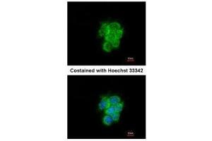 ICC/IF Image Immunofluorescence analysis of methanol-fixed A431, using MIPEP, antibody at 1:200 dilution. (MIPEP antibody)