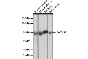 Western blot analysis of extracts of various cell lines, using tPA/tPA/PLAT Rabbit mAb (ABIN1678727, ABIN3018699, ABIN3018700 and ABIN7101650) at 1:1000 dilution.