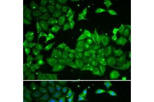 Immunofluorescence analysis of HeLa cells using ALDH3A1 Polyclonal Antibody (ALDH3A1 antibody)