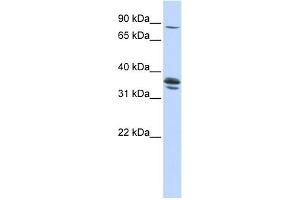 WB Suggested Anti-SLCO3A1 Antibody Titration:  0. (Solute Carrier Organic Anion Transporter Family, Member 3A1 (SLCO3A1) (Middle Region) antibody)