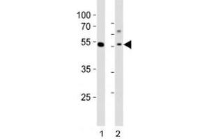 Western blot analysis of lysate from 1) human MCF-7 cell line and 2) mouse liver tissue tissue using Gata6 antibody at 1:1000.