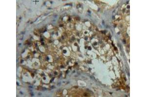 Used in DAB staining on fromalin fixed paraffin-embedded testis tissue (LEFTY2 antibody  (AA 245-356))