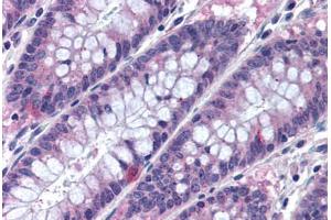 Human Colon (formalin-fixed, paraffin-embedded) stained with MTSS1 antibody ABIN290367 at 10 ug/ml followed by biotinylated goat anti-rabbit IgG secondary antibody ABIN481713, alkaline phosphatase-streptavidin and chromogen. (MTSS1 antibody  (AA 670-720))