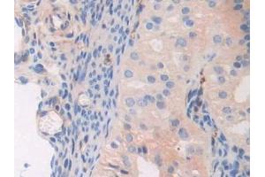 Detection of MYL3 in Mouse Oviduct Tissue using Polyclonal Antibody to Myosin Light Chain 3, Alkali, Ventricular, Slow Skeletal (MYL3)