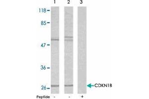 Western blot analysis using CDKN1B polyclonal antibody  . (CDKN1B antibody  (Ser10))