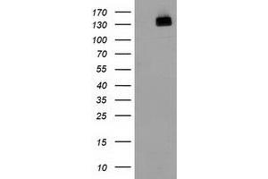 HEK293T cells were transfected with the pCMV6-ENTRY control (Left lane) or pCMV6-ENTRY HDAC6 (Right lane) cDNA for 48 hrs and lysed. (HDAC6 antibody)