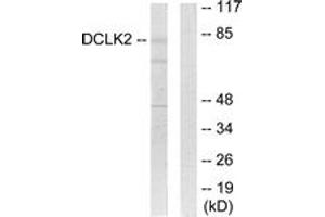 Western blot analysis of extracts from HepG2 cells, using DCLK2 Antibody. (DCLK2 antibody  (AA 1-50))
