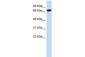 WB Suggested Anti-C1orf65 Antibody Titration: 0. (C1orf65 antibody  (N-Term))
