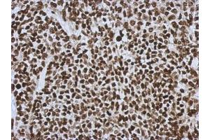Immunohistochemistry (IHC) image for anti-High Mobility Group Box 1 (HMGB1) antibody (ABIN2854997)