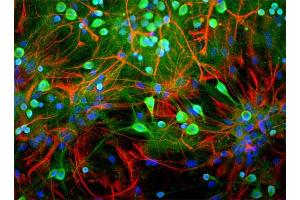 Rat mixed neuron/glial cultures stained with chicken UCHL1 (green) and rabbit antibody to glial fibrillary acidic protein (GFAP-red). (UCHL1 antibody)