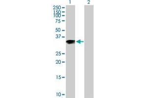 Western Blot analysis of ARL10 expression in transfected 293T cell line by ARL10 MaxPab polyclonal antibody. (ARL10 antibody  (AA 1-276))